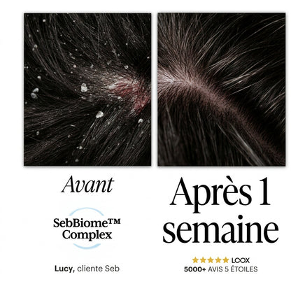 Seb Sérum Apaisant Naturel