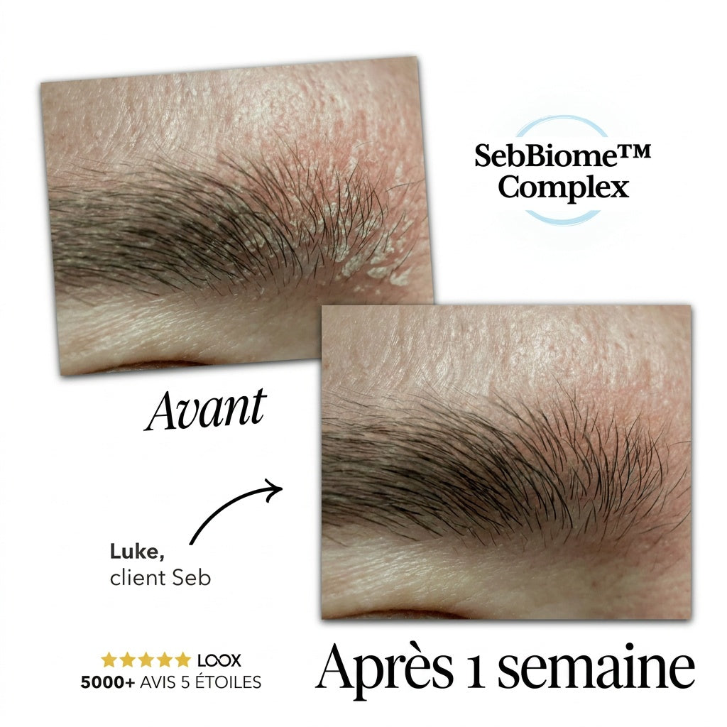 Seb Sérum Apaisant Naturel