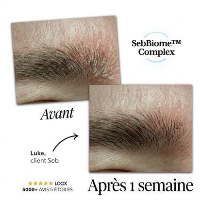 Seb Sérum Apaisant Naturel