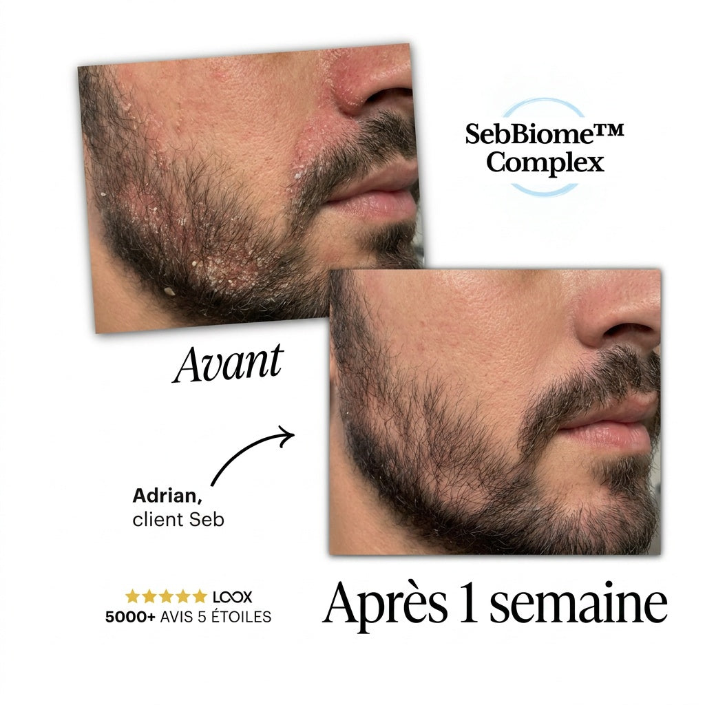 Seb Sérum Apaisant Naturel