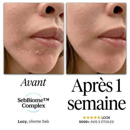 Seb Sérum Apaisant Naturel