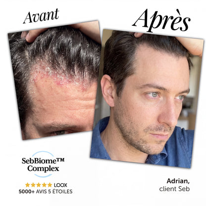 Seb Sérum Apaisant Naturel