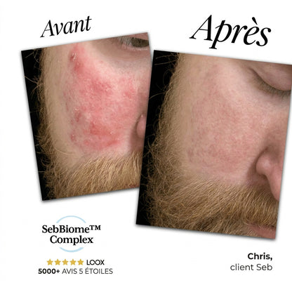 Seb Sérum Apaisant Naturel