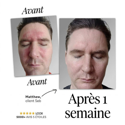 Seb Sérum Apaisant Naturel