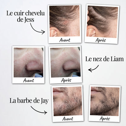 Seb Sérum Apaisant Naturel
